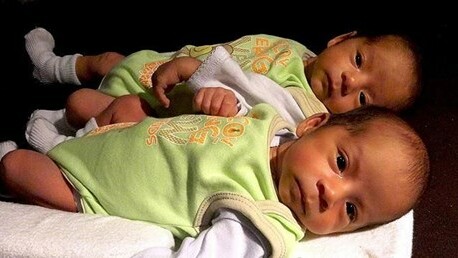 Tek yumurta ikizleri moleküler açıdan da benzer